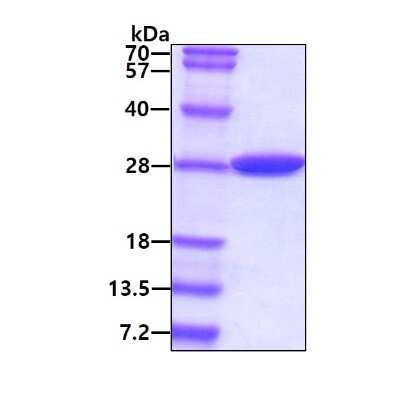 SDS-PAGE Recombinant E. coli Carbonic Anhydrase II/CA2 His Protein